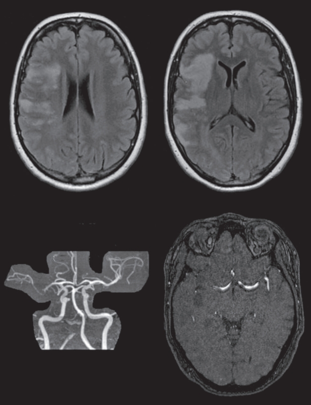 neuroint-2020-00087f1.jpg