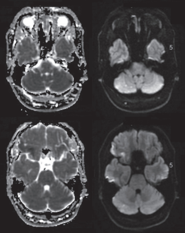neuroint-2020-00087f4.jpg